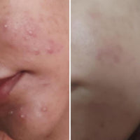 Nirvana Botanics Vitamin C + E Serum – 15ml | Anti Acne & Glowing Serum Vitamin C + E